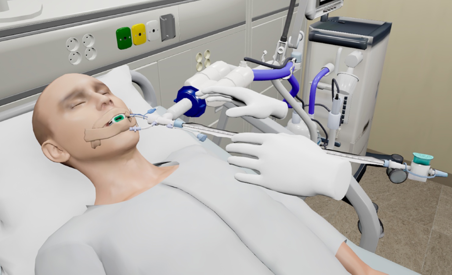 Ventilación mecánica VR - Imagen 3