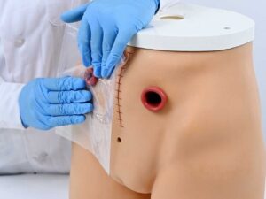 Simulador de cuidado de ostomía NUE016.01