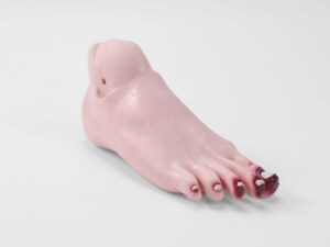 Modelo de cuidado del pie diabético (PRA020.01)