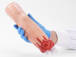 Amputación y traumatismo con sangrado en el brazo (PRA019.03)