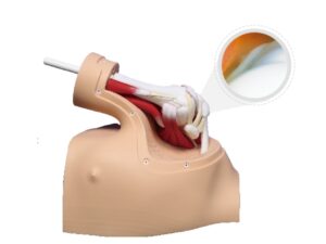 Modelo de entrenamiento para cirugía artroscópica de hombro - MEE065