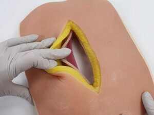 Entrenador de sutura de fascia abdominal A-AFS-01